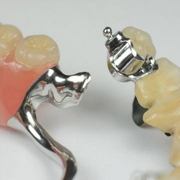Precision attachments/Dentures