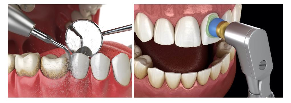 dental-hygienist
