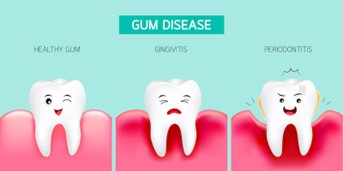 gum-disease